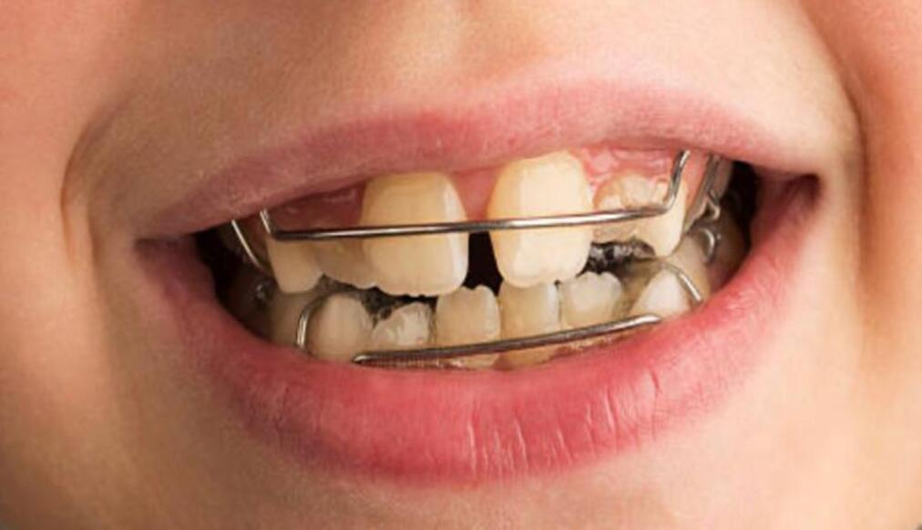 patient smiling
